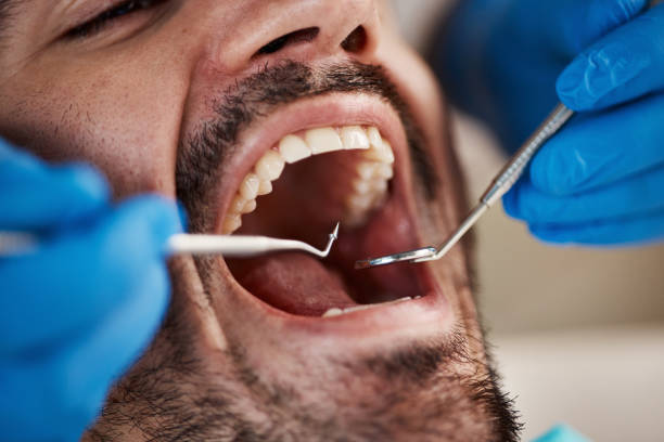 Best Emergency Dental Care for Trauma or Injury in Newington, VA