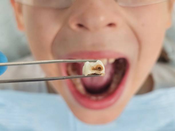 Best After-Hours Emergency Dentist in Newington, VA
