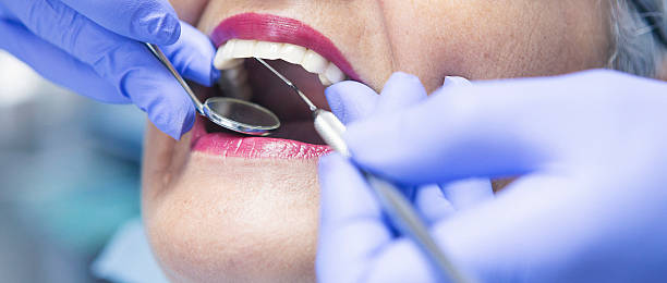 Best Emergency Tooth Extraction in Newington, VA